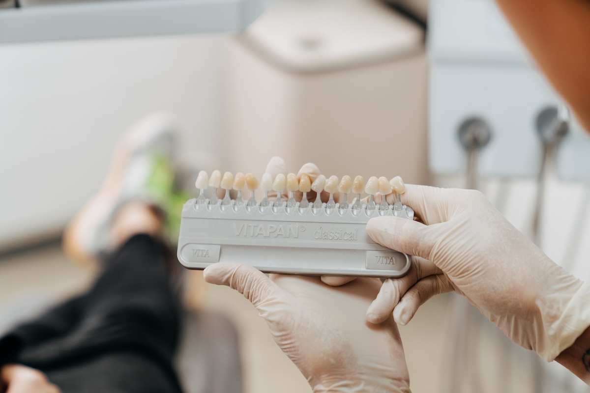 Prophylaxefachkraft hält eine Palette mit verschiedenen Zahnfarben in der Hand, anhand derer das Ergebnis des Bleachings bestimmt wird