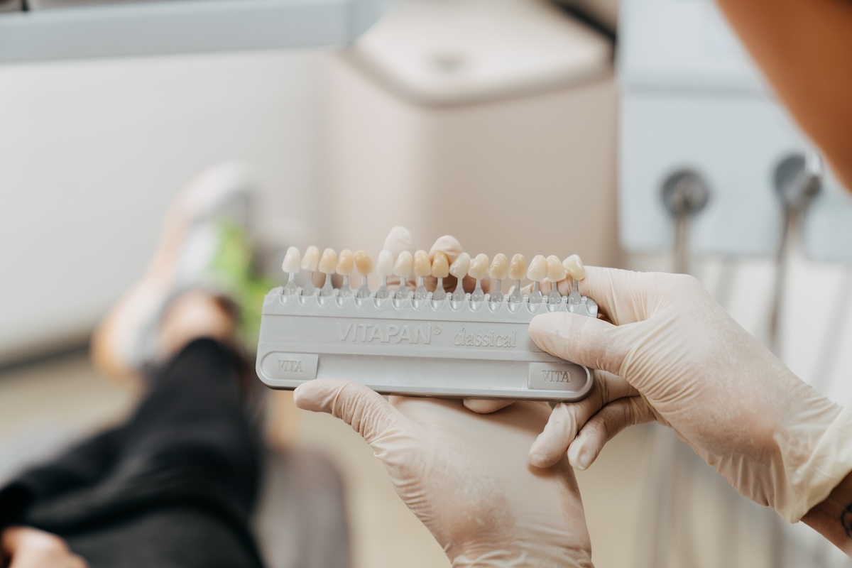 Nahaufnahme einer Zahnfarbenpalette, anhand derer der Patient oder die Patientin die Zahnfarbe für ihr Bleaching auswählt